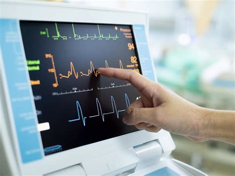 The ECG and Its Technology .